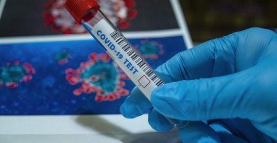 Novi antigenski testovi u laboratoriji JZU Bolnica Gradiška