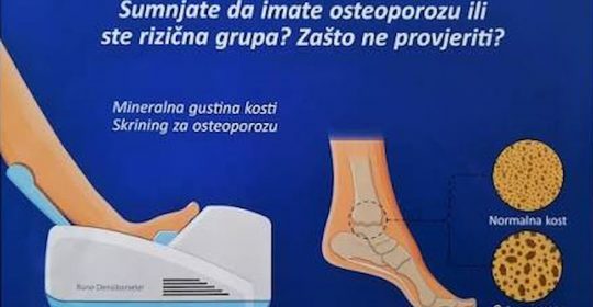 Besplatno mjerenje koštane gustine